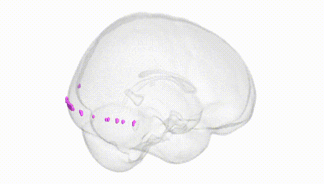 Full Brain White