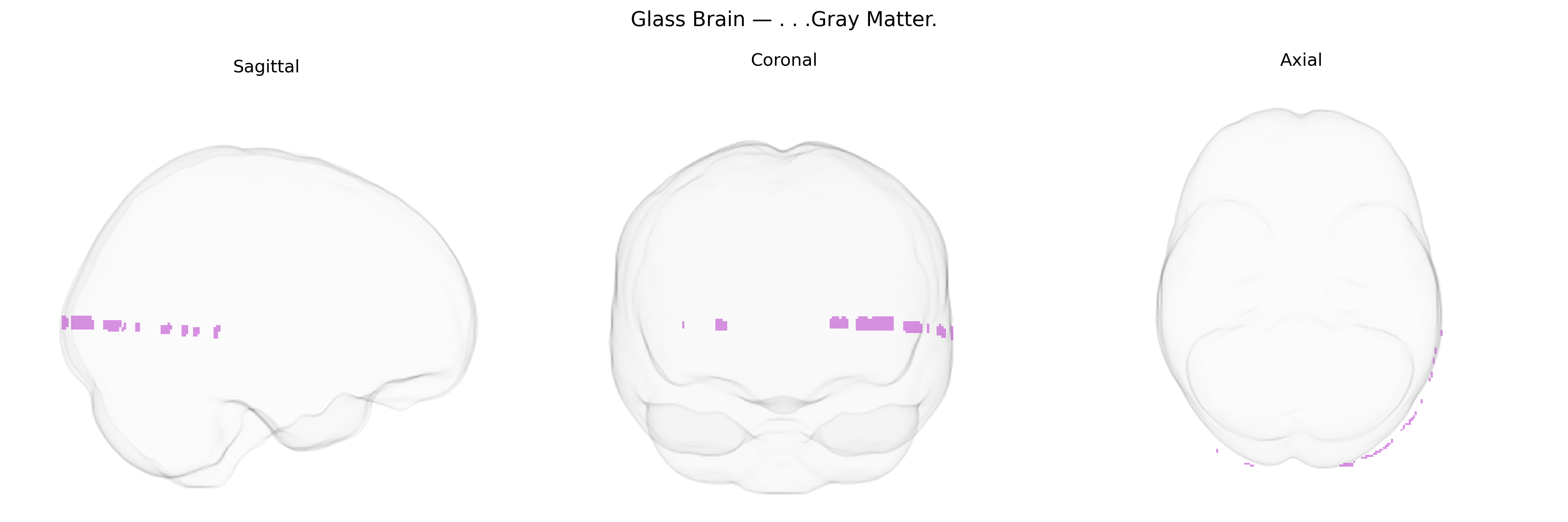 Triplanar Ghost Brain
