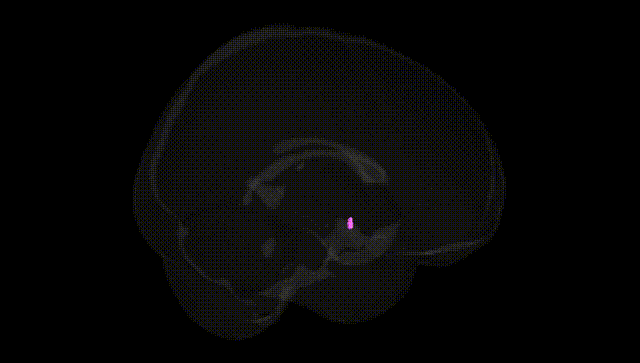 Full Brain Black