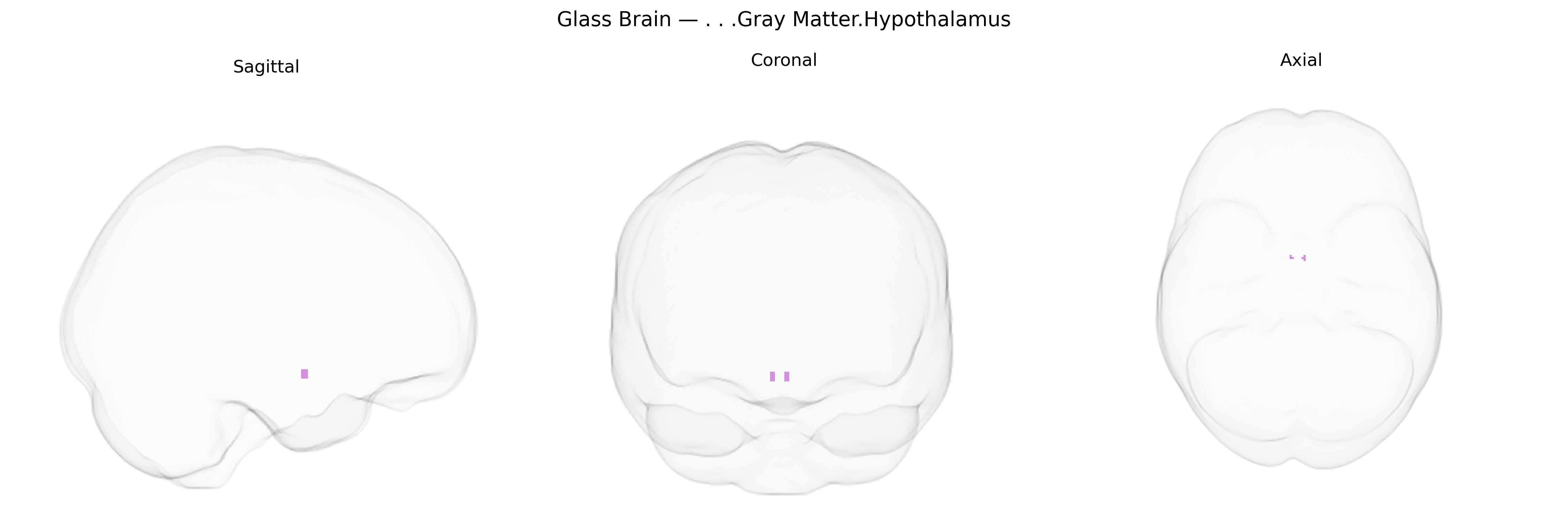 Triplanar Ghost Brain