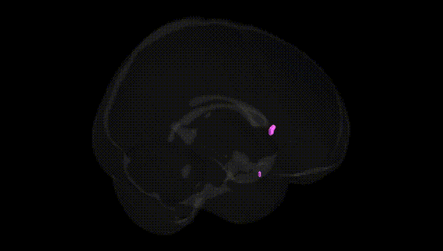 Full Brain Black