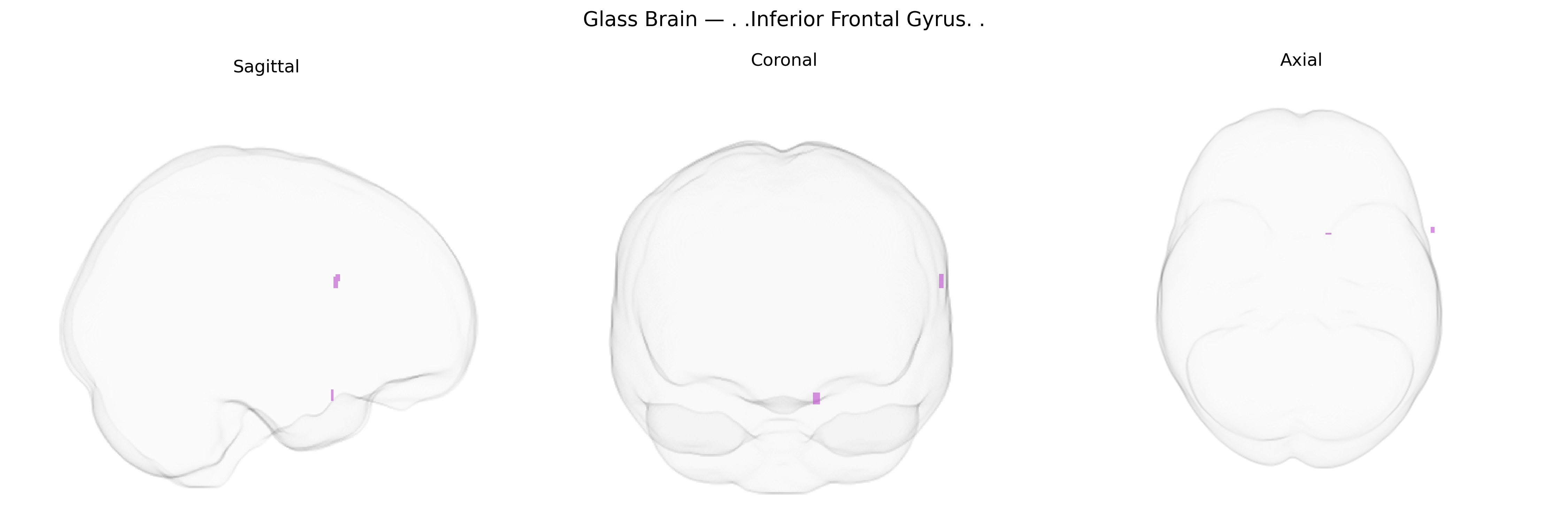 Triplanar Ghost Brain