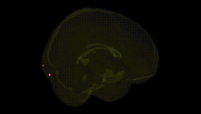 Full Brain Black