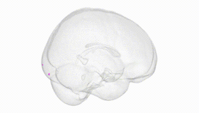 Full Brain White