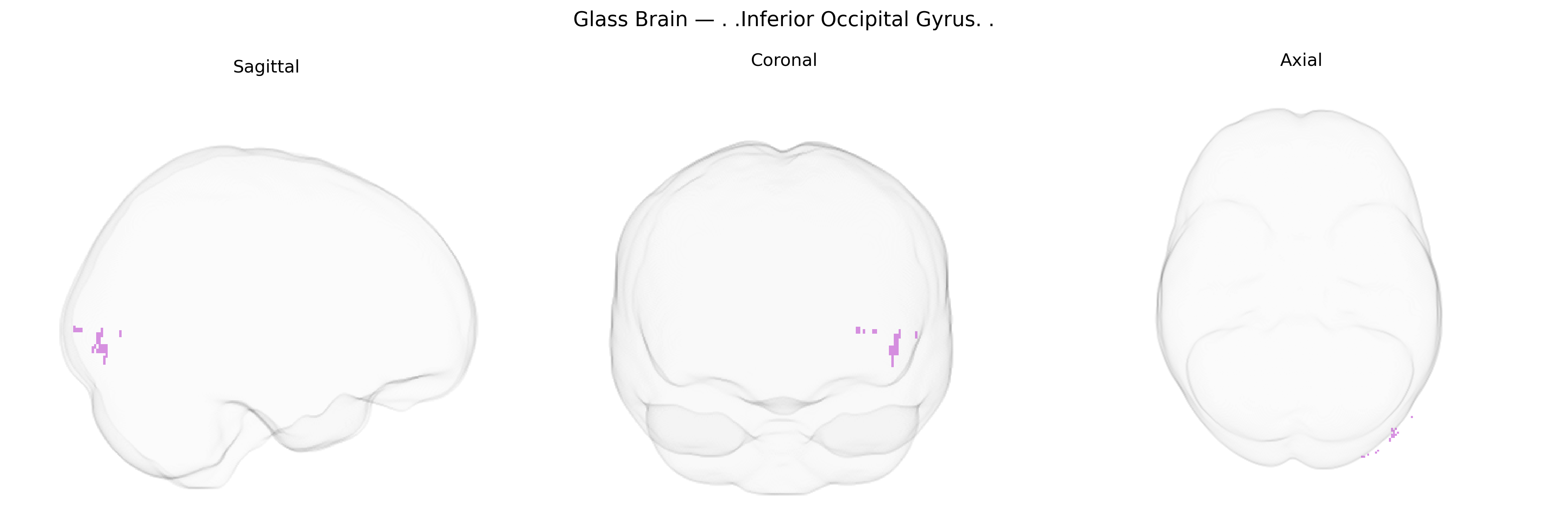 Triplanar Ghost Brain