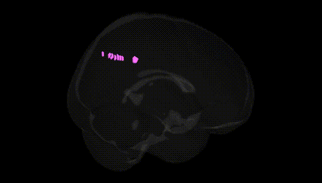 Full Brain Black