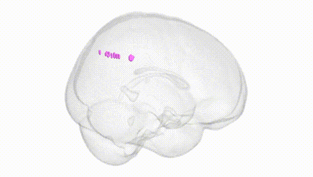 Full Brain White