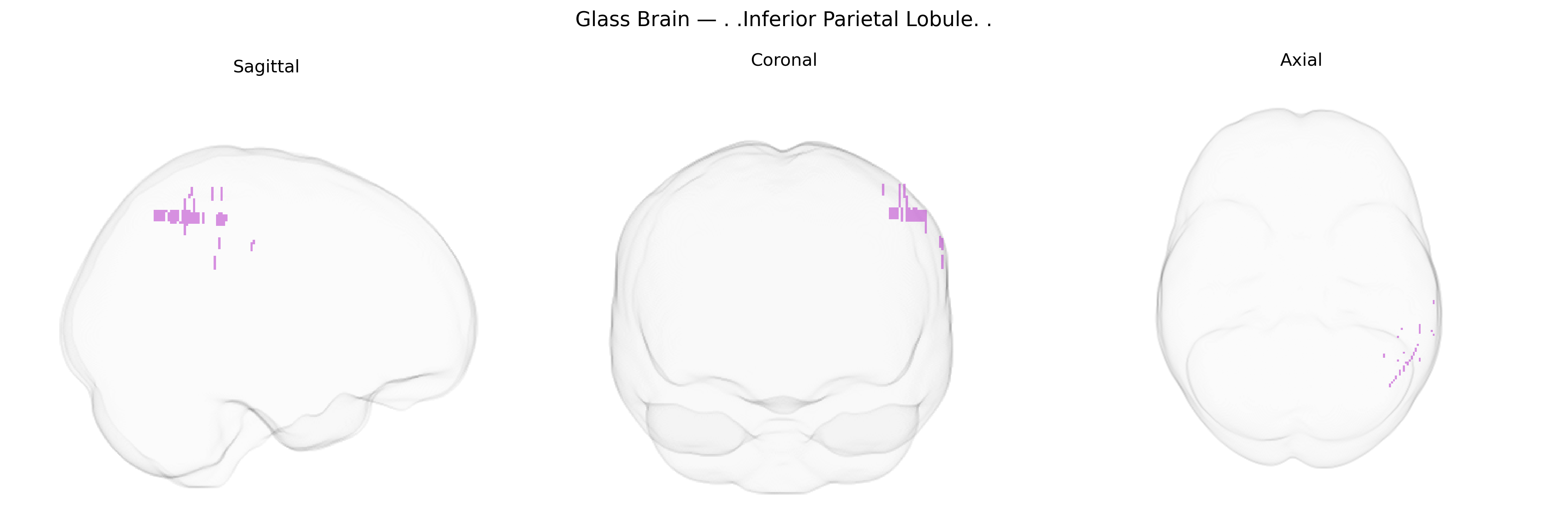 Triplanar Ghost Brain
