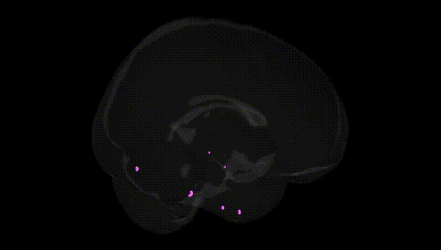Full Brain Black
