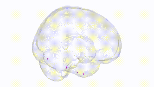 Full Brain White