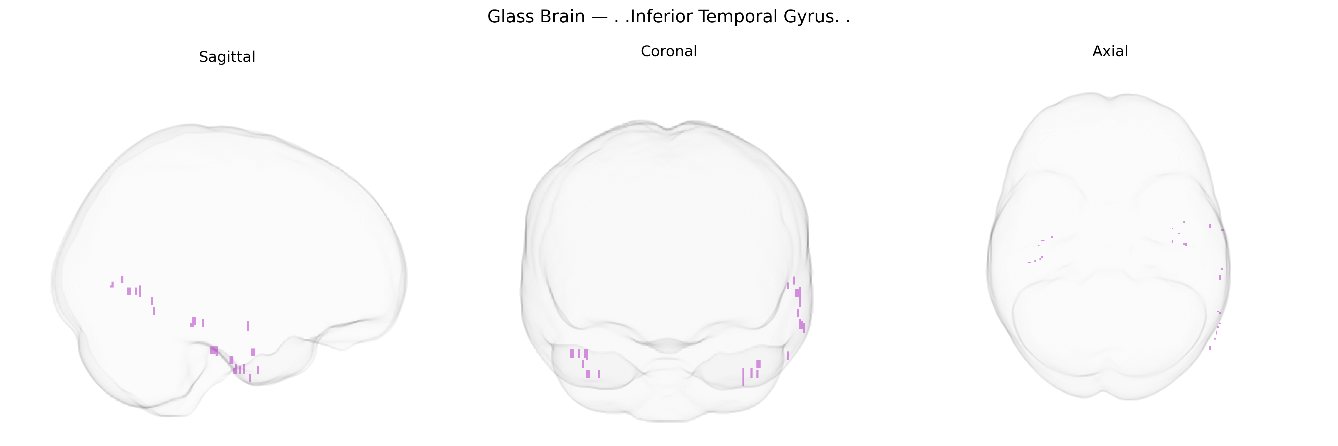 Triplanar Ghost Brain