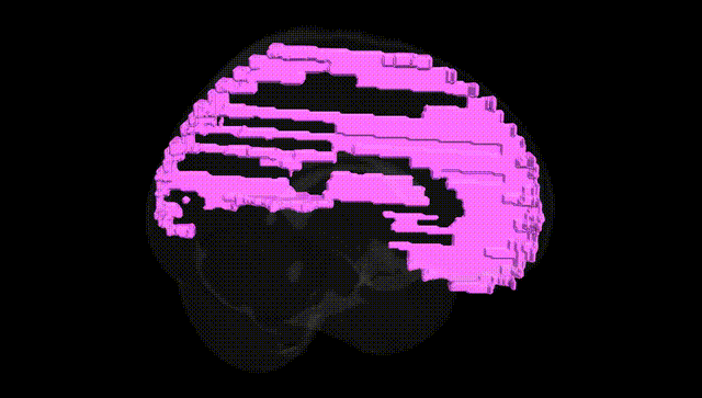 Full Brain Black