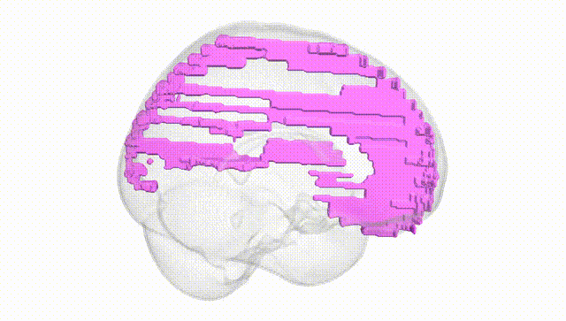 Full Brain White