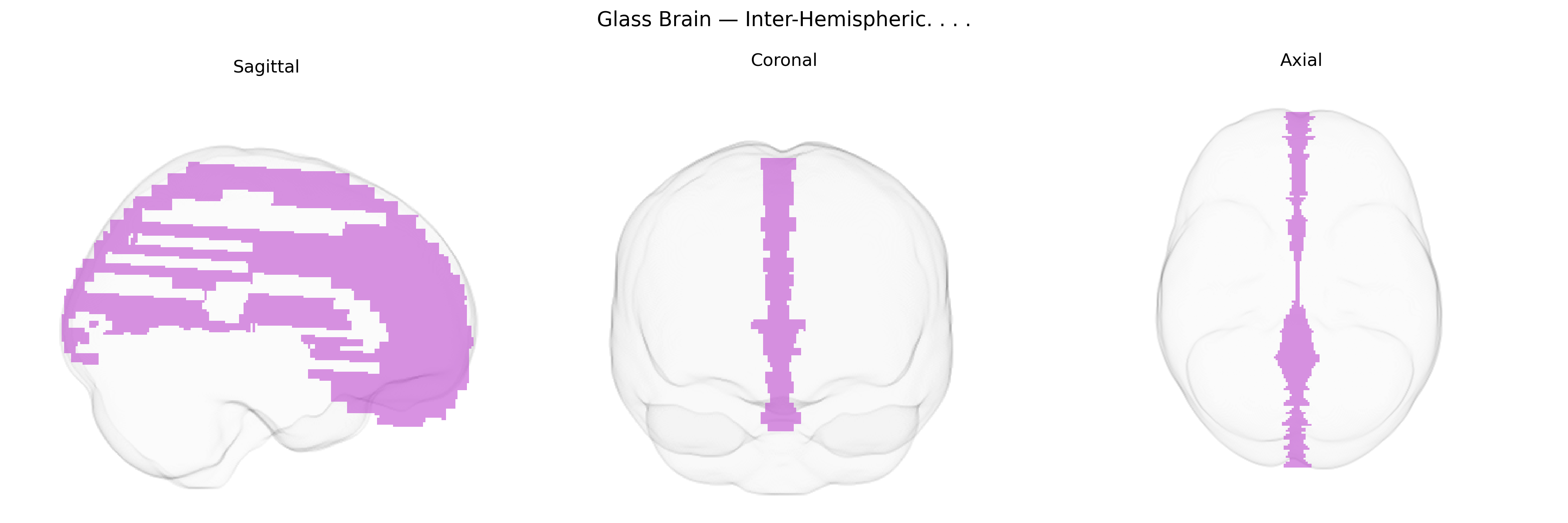 Triplanar Ghost Brain