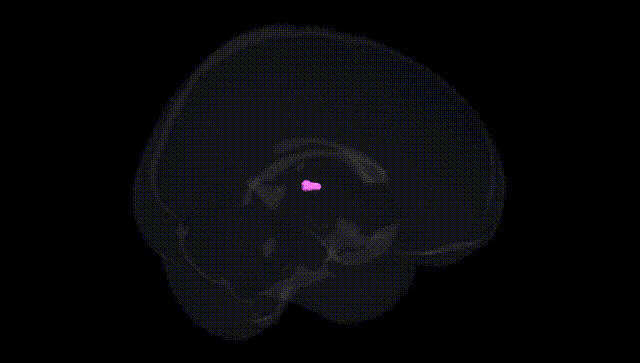 Full Brain Black