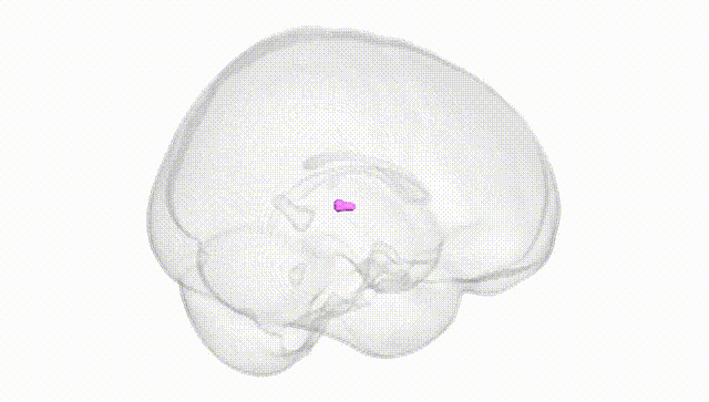 Full Brain White