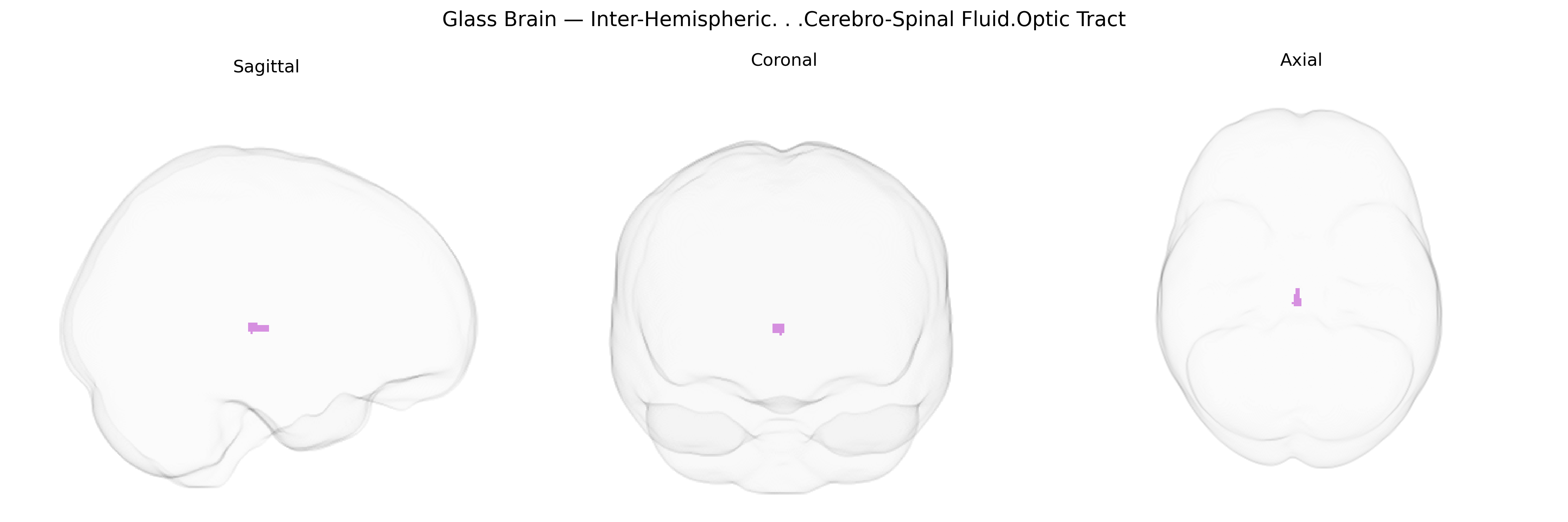 Triplanar Ghost Brain