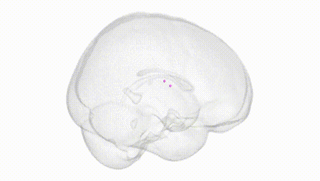 Full Brain White