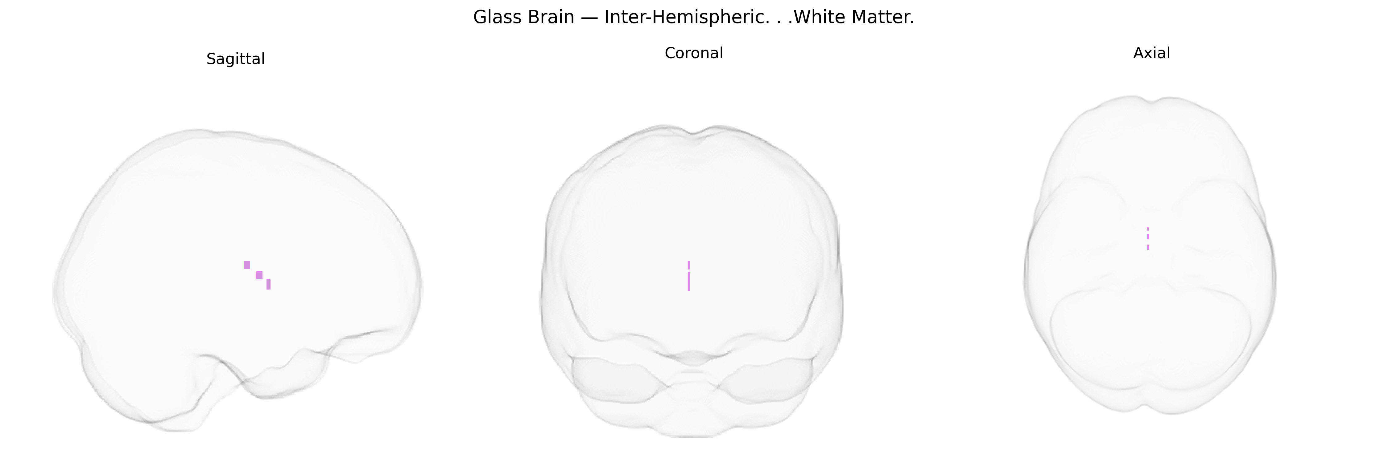 Triplanar Ghost Brain