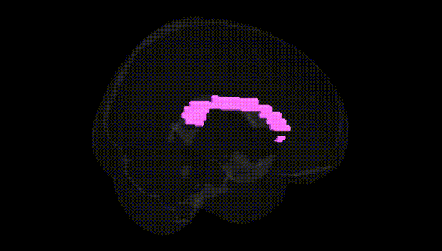 Full Brain Black