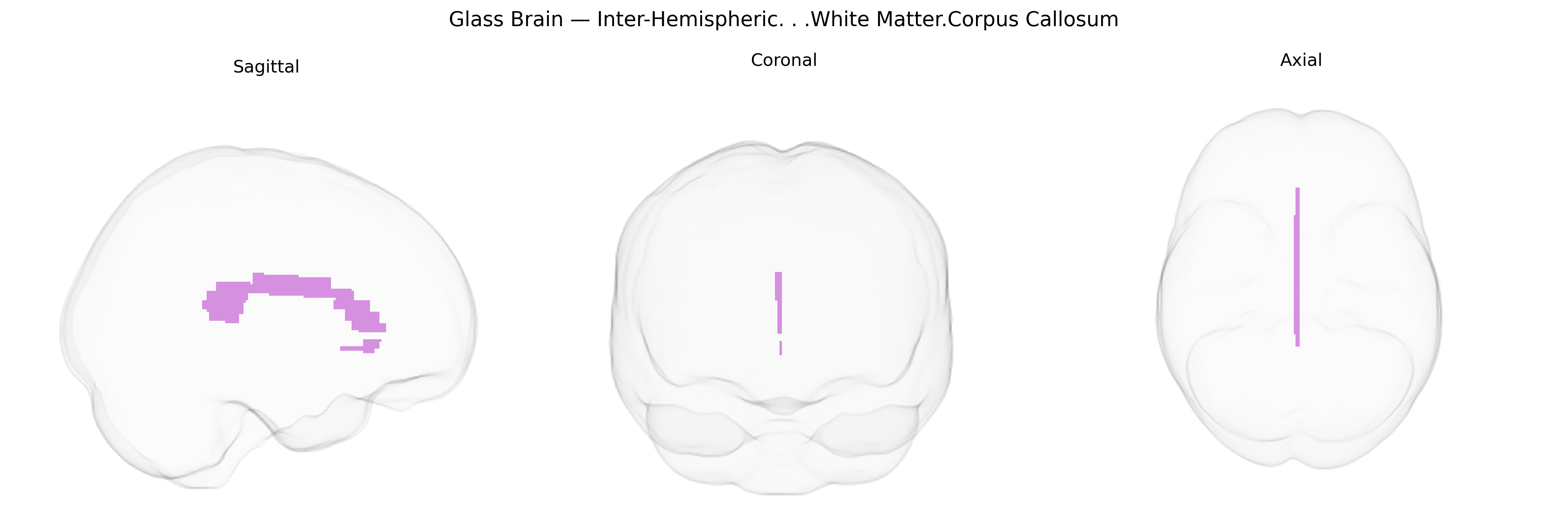 Triplanar Ghost Brain
