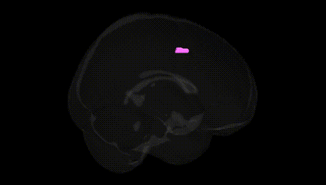 Full Brain Black