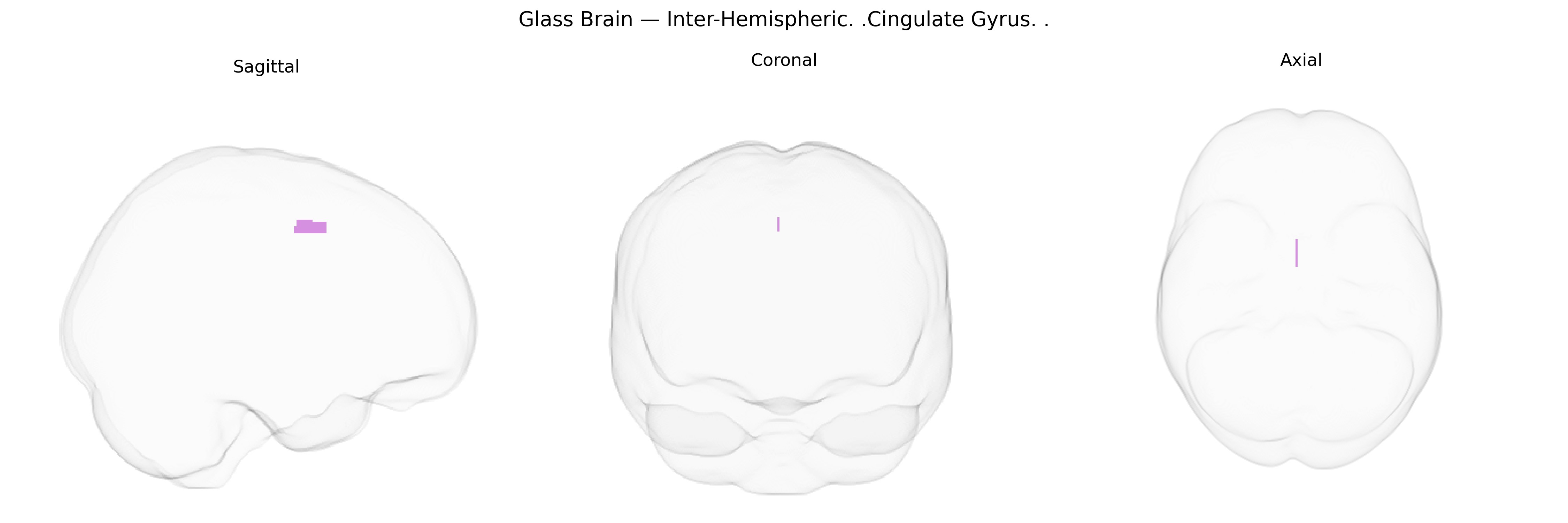 Triplanar Ghost Brain