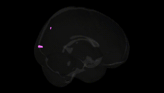 Full Brain Black