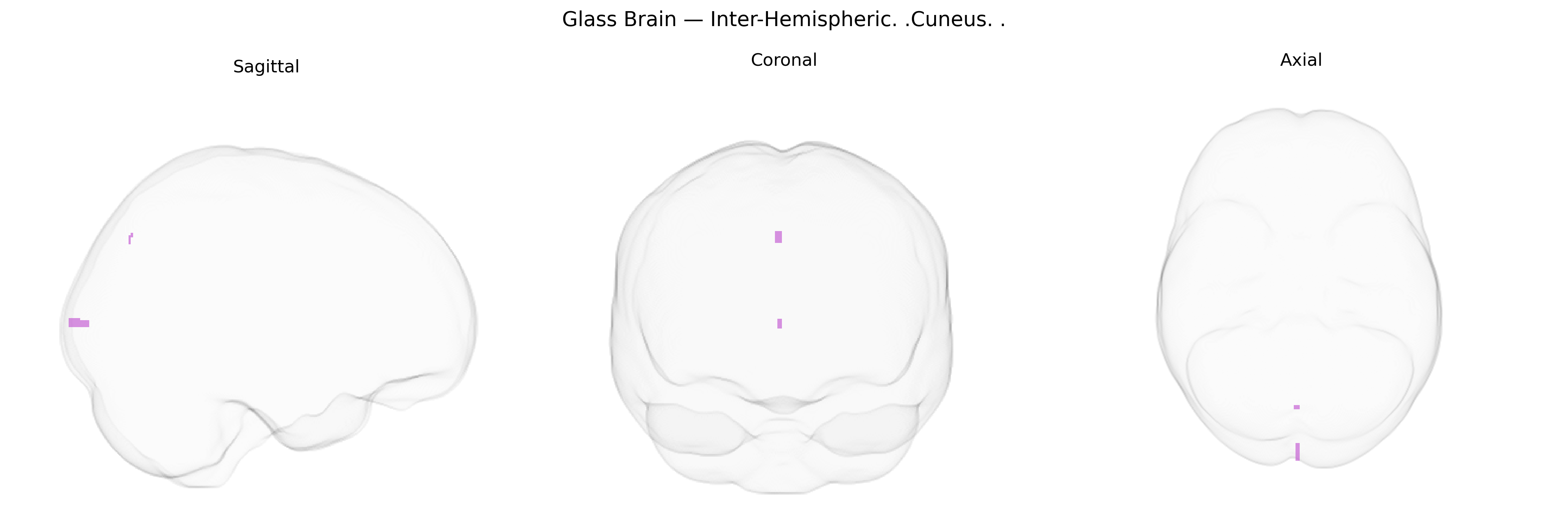 Triplanar Ghost Brain