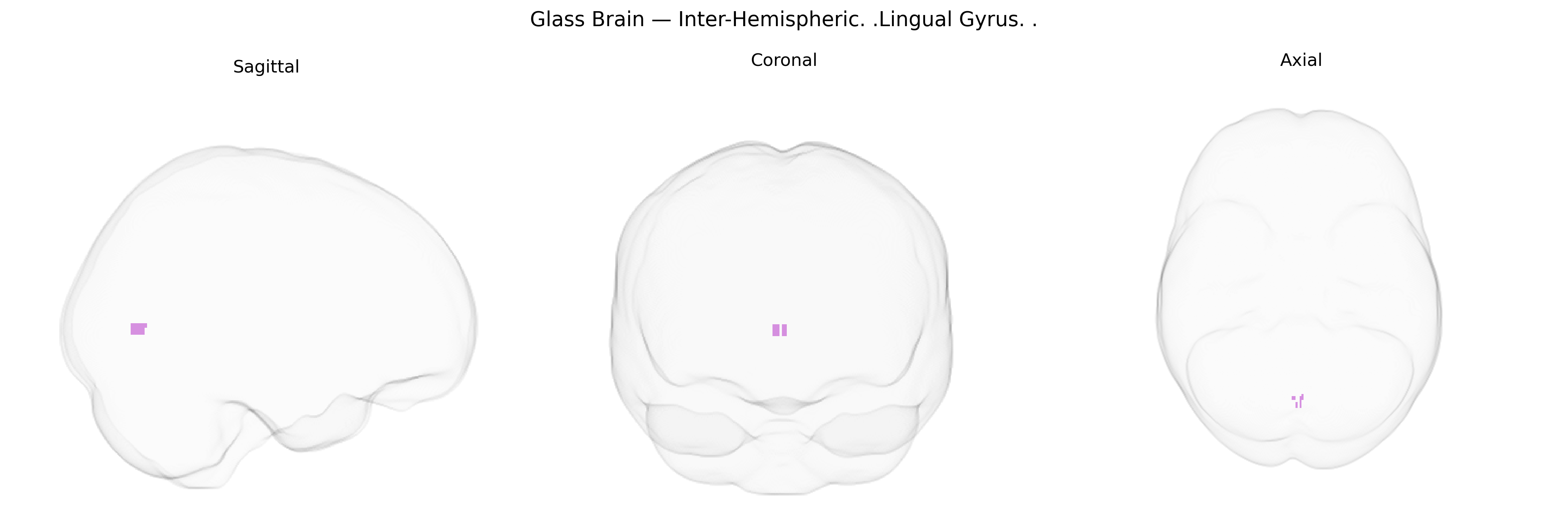 Triplanar Ghost Brain