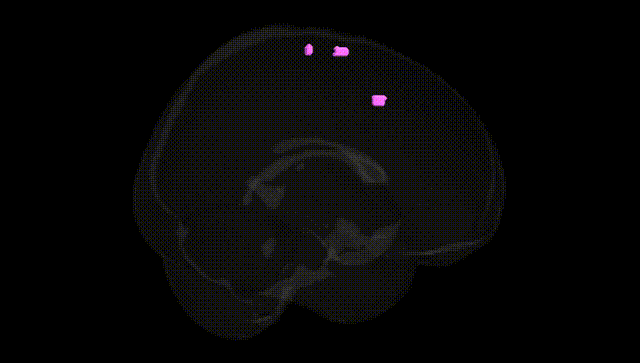 Full Brain Black