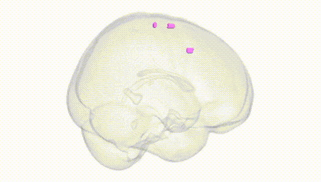 Full Brain White