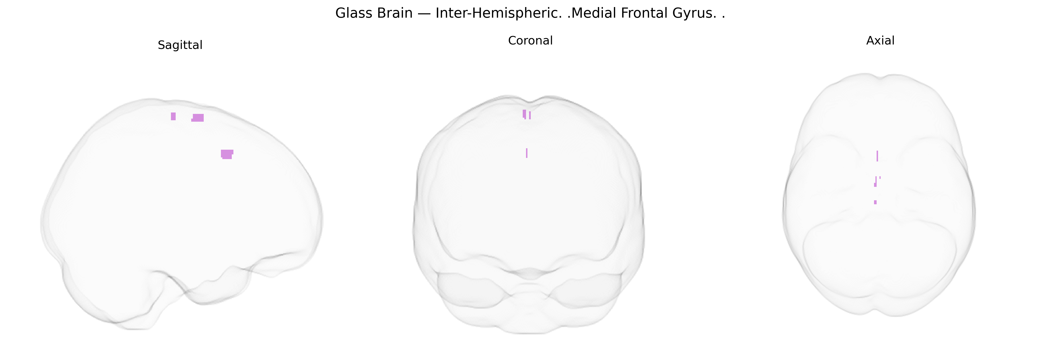 Triplanar Ghost Brain