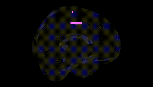 Full Brain Black