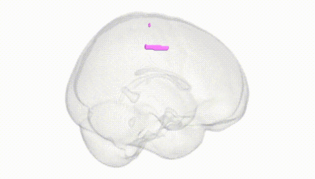 Full Brain White