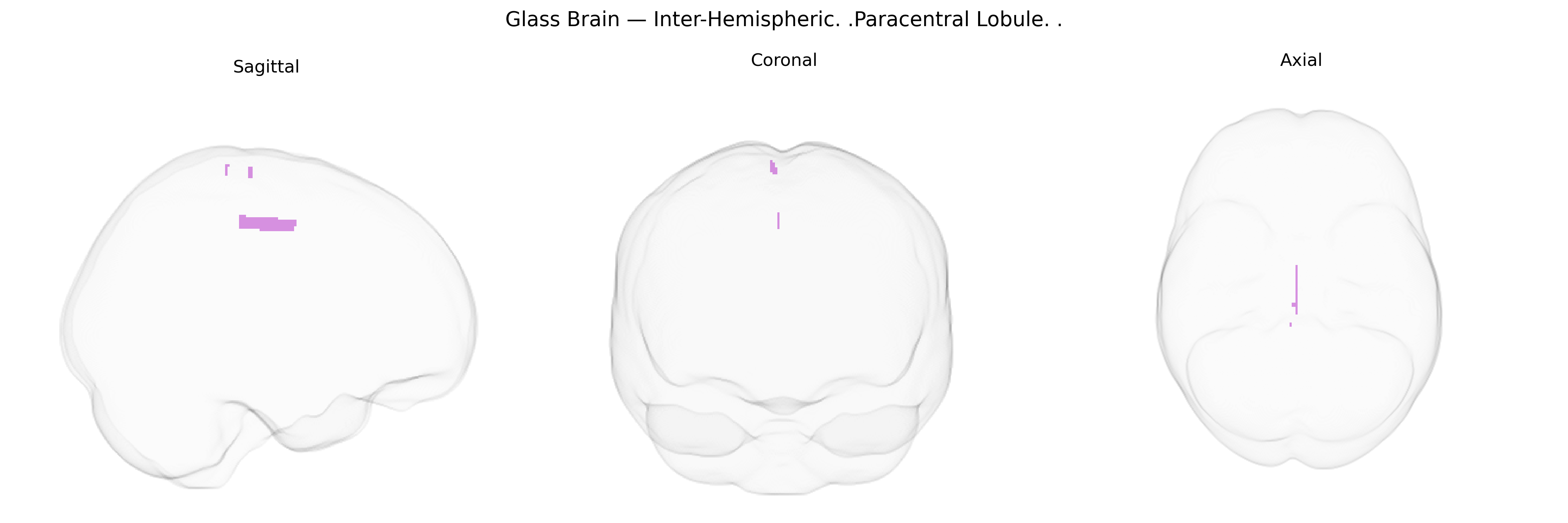 Triplanar Ghost Brain