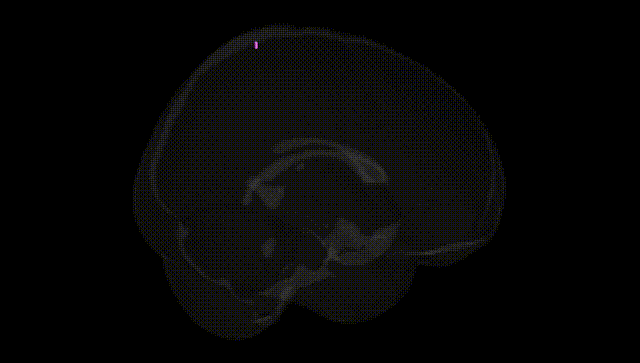 Full Brain Black