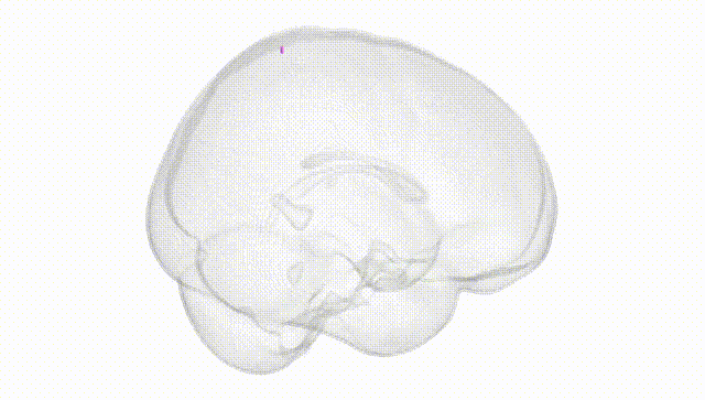 Full Brain White