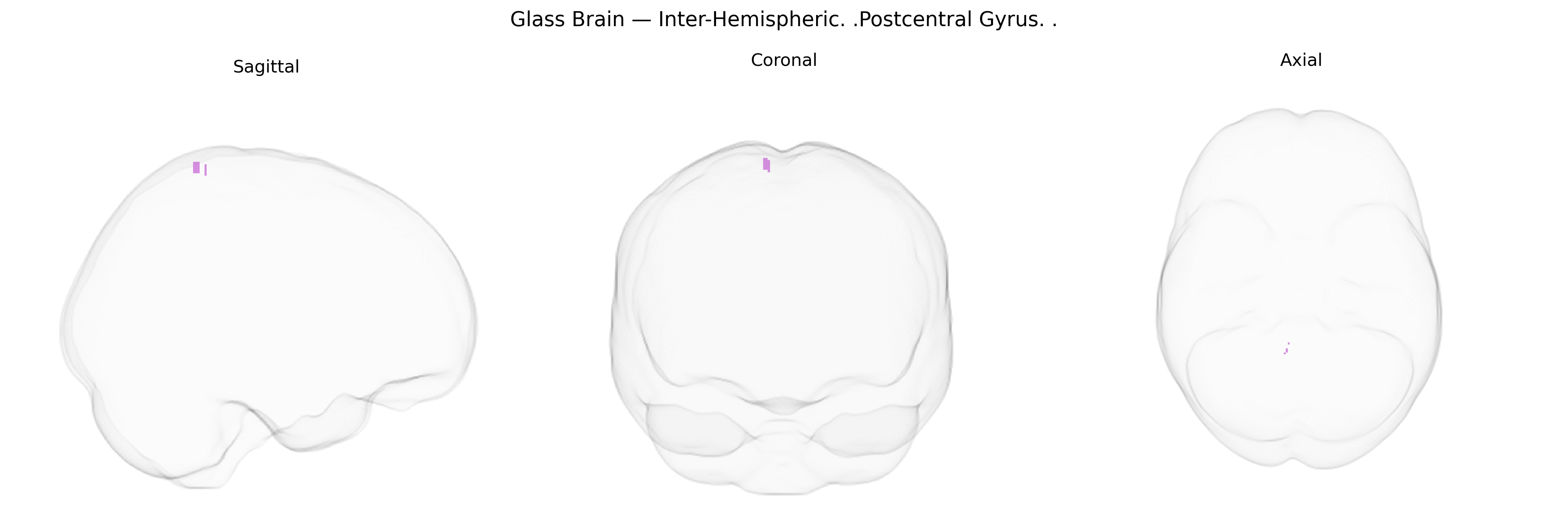 Triplanar Ghost Brain