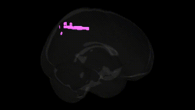 Full Brain Black