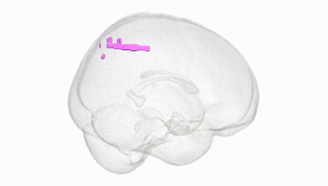 Full Brain White