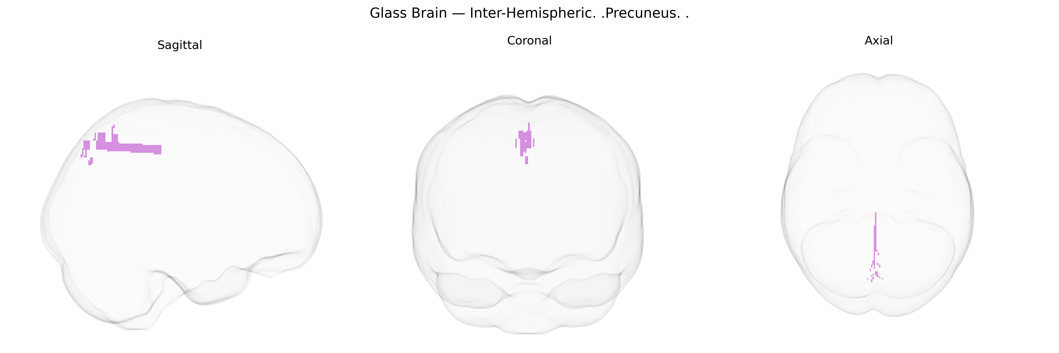 Triplanar Ghost Brain