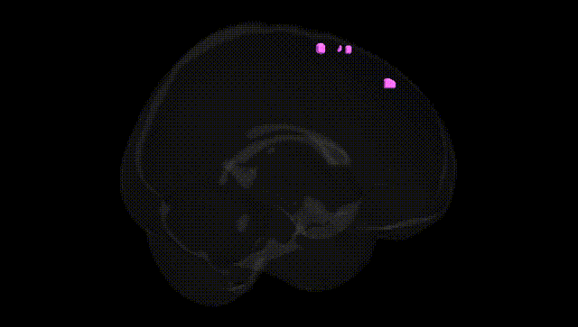 Full Brain Black