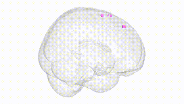 Full Brain White