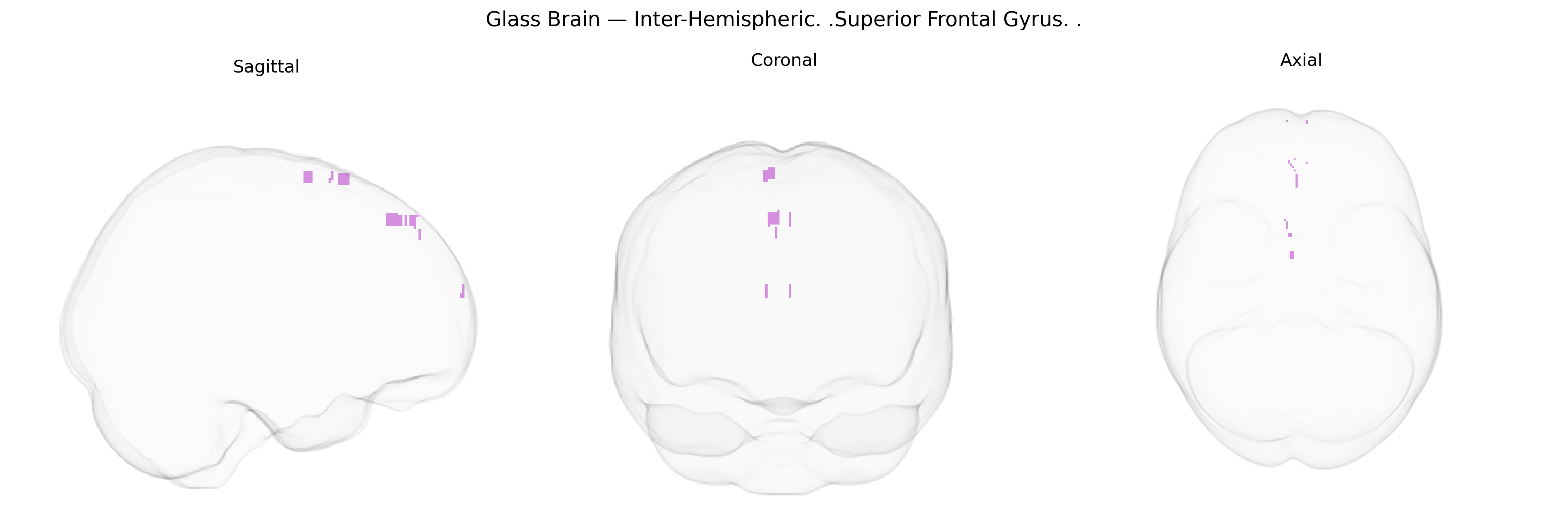 Triplanar Ghost Brain