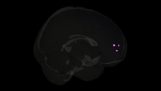 Full Brain Black