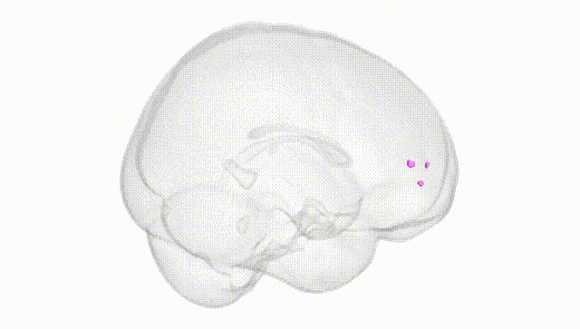 Full Brain White