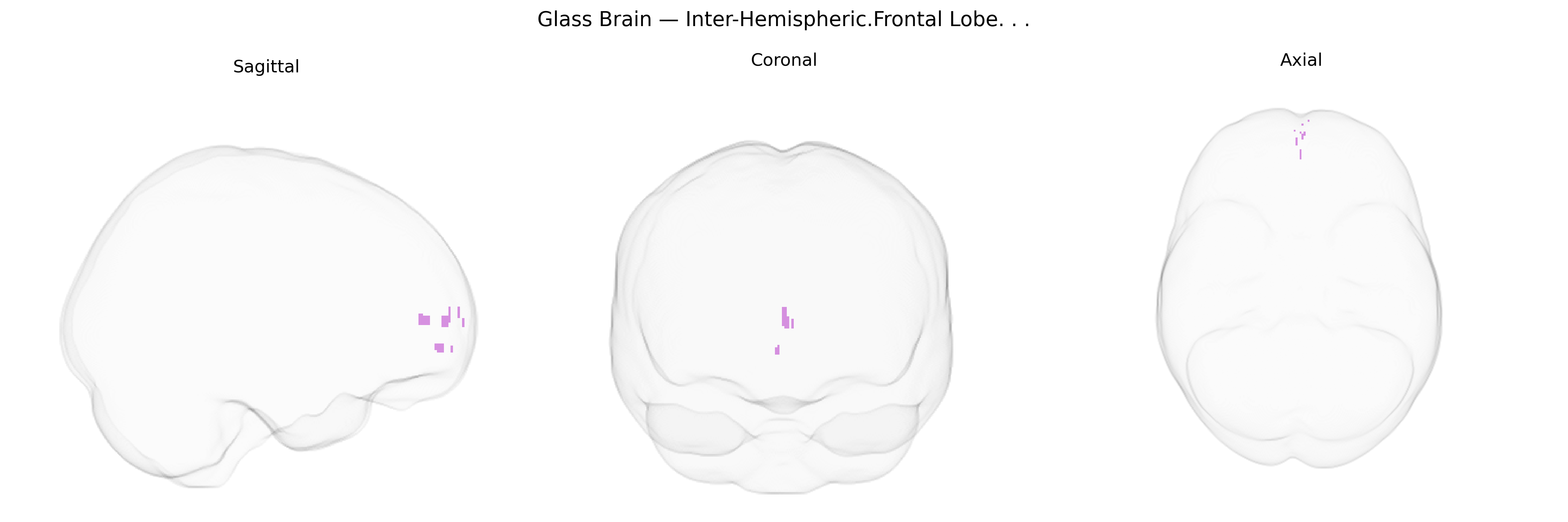 Triplanar Ghost Brain