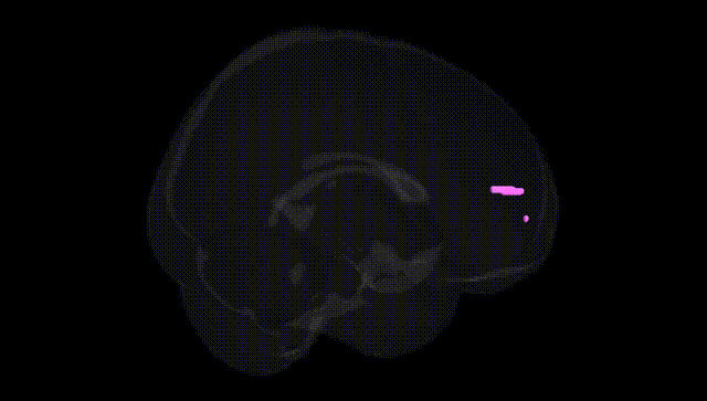 Full Brain Black