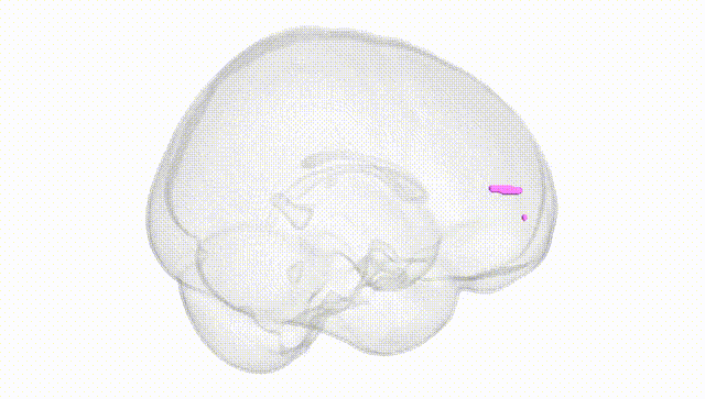Full Brain White